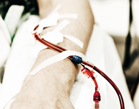 Χέρι ασθενούς που υποβάλλεται σε θεραπεία κατ’ οίκον αιμοκάθαρσης