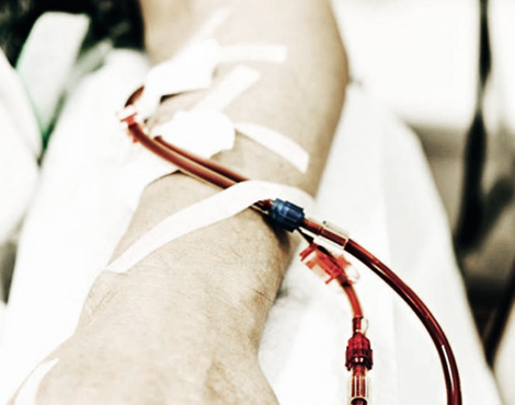 Χέρι ασθενούς που υποβάλλεται σε αιμοκάθαρση σε μονάδα αιμοκάθαρσης